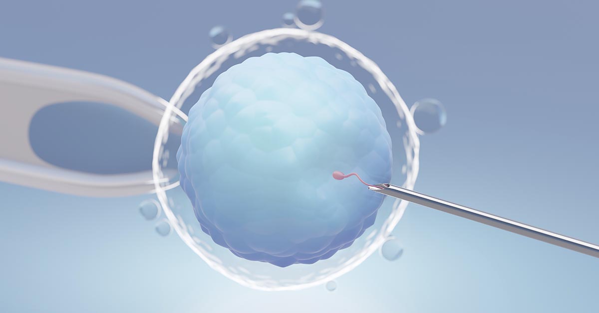 Como é feita a inseminação artificial: guia do procedimento