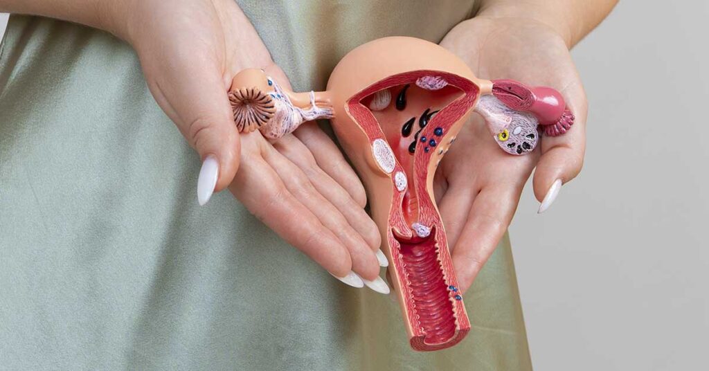 É possível engravidar com trompas obstruídas? Entenda quando há chance natural e quando tratar